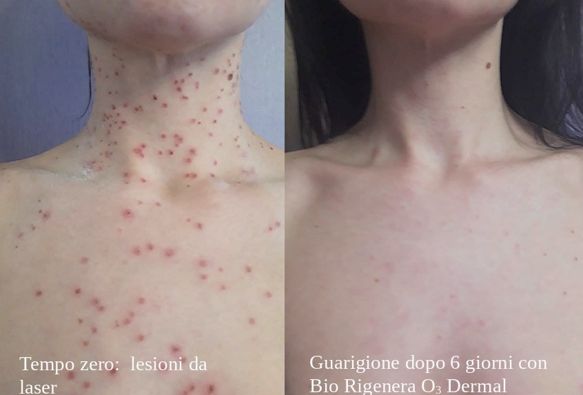 Bio RIGENERA Dermal Lipogel Bio Rigenerante e Bio Riparatore 25 ml - immagine 3